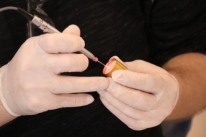 An eyelid lift in Munich can also be done with laser treatment
